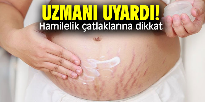 Uzmanı uyardı! Hamilelik çatlaklarına dikkat