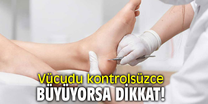 Vücudu kontrolsüzce büyüyorsa dikkat!