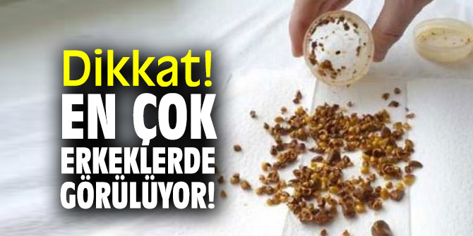 Dikkat! En çok erkeklerde görülüyor!