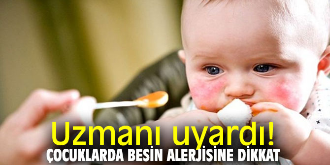 Uzmanı uyardı! Çocuklarda besin alerjisine dikkat