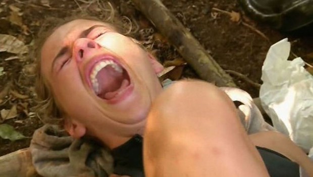 Survivor'da Şok Eden Kaza!