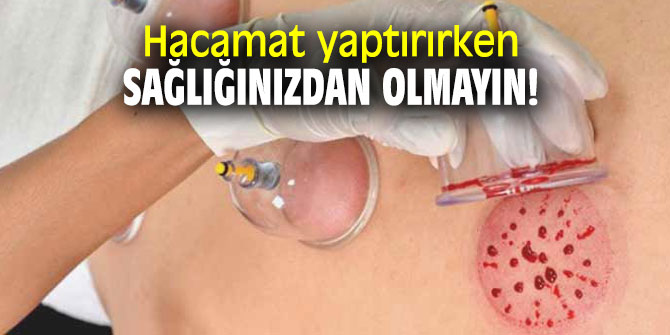 Hacamat yaptırırken sağlığınızdan olmayın!