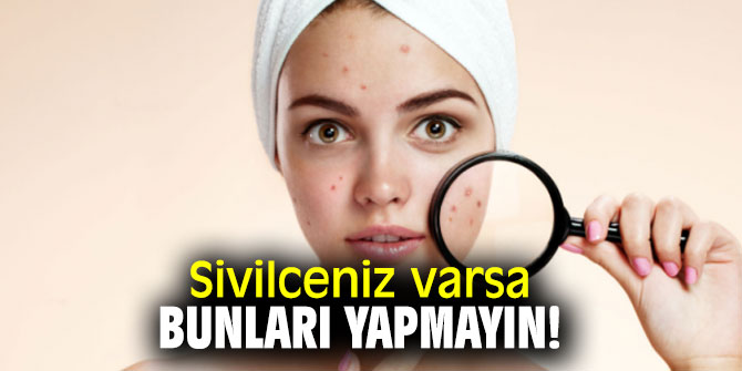 Uzmanı uyardı: Sivilceniz varsa bunları yapmayın!
