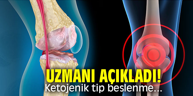 Uzmanı açıkladı! Ketojenik tip beslenme...