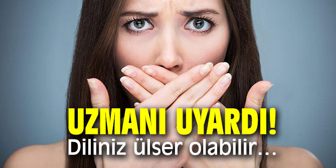 Uzmanı uyardı! Diliniz ülser olabilir…