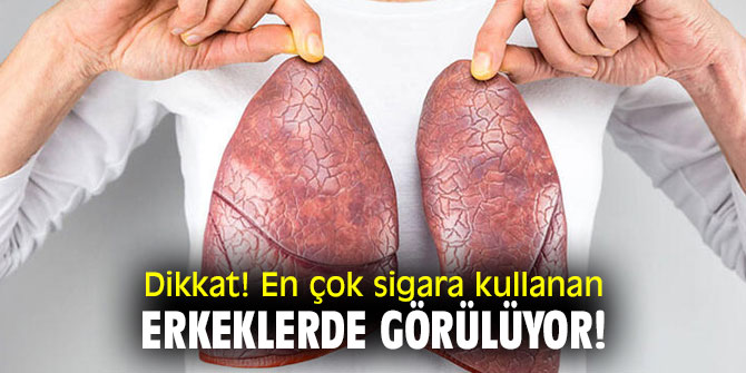 Dikkat! En çok sigara kullanan erkeklerde görülüyor!