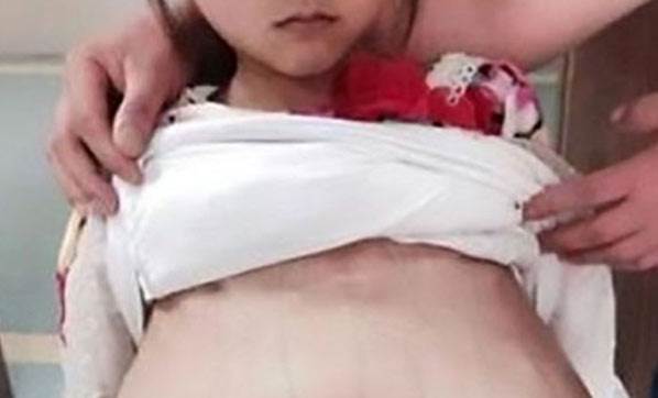 12 Yaşındaki Çocukla Evlendi Hamile Bıraktı