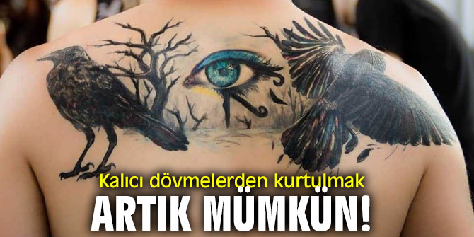 Kalıcı dövmelerden kurtulmak artık mümkün!
