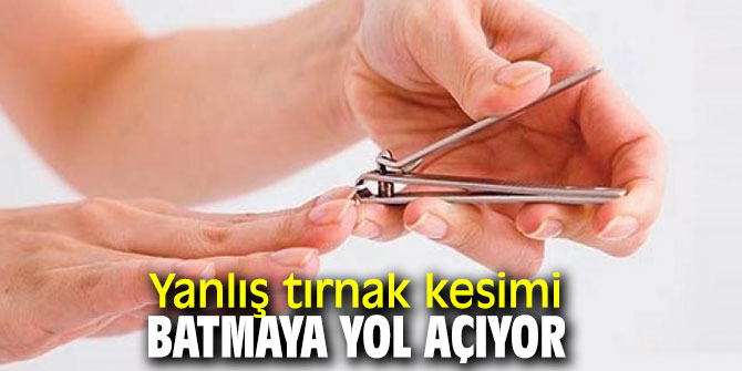 Dikkat! Yanlış tırnak kesimi batmaya yol açıyor