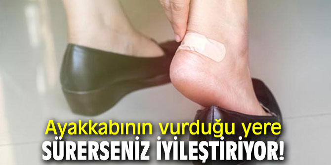 İşte ayakkabı vurmasına çözüm önerileri