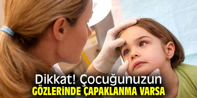 Dikkat! Çocuğunuzun gözlerinde çapaklanma varsa...