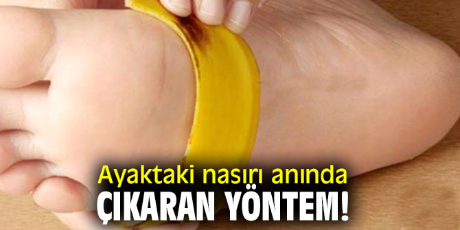 Dikkat! Ayağınızda nasır varsa, bu yöntemler işe yarar