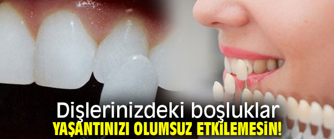 Dişlerinizdeki boşlukların tedavisi tek seans!