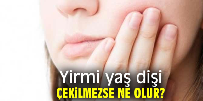 Yirmi yaş dişi başınıza dert olmasın!
