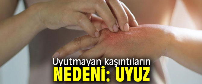 Dikkat! Uyutmayan kaşıntıların nedeni uyuz olabilir!