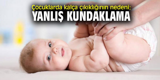 Dikkat! Yanlış kundaklama kalça çıkıklığına neden oluyor