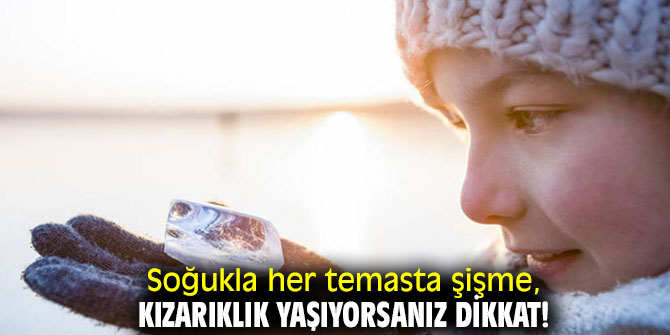 Soğuk alerjisine dikkat!