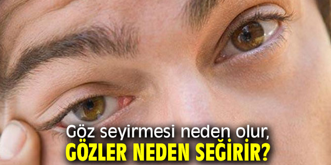 Uzmanı uyardı! Göz seyirmesini önemseyin