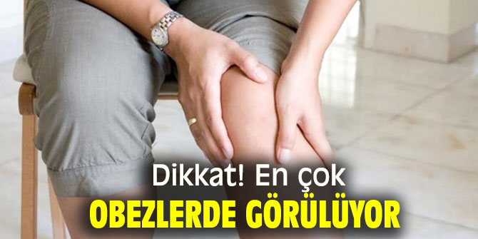 En çok obezlerde görülüyor