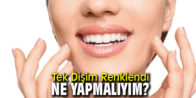 Tek diş renklenmesinde ne yapılmalı!