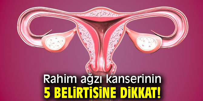 Dikkat! Bu belirtiler Rahim ağzı kanserinin habercisi!