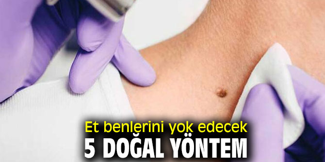 Bu yöntemler et benleri yok ediyor!