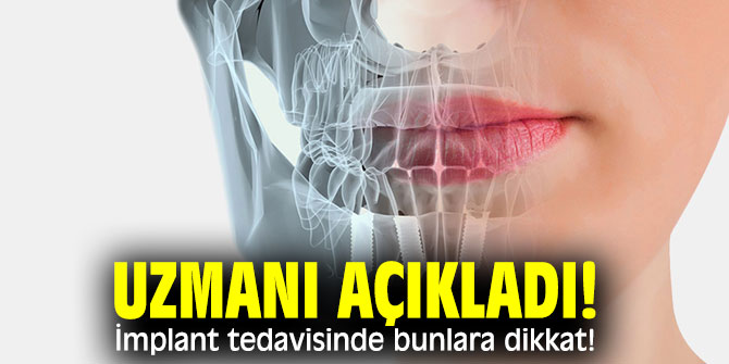 Uzmanı açıkladı! İmplant tedavisinde bunlara dikkat!