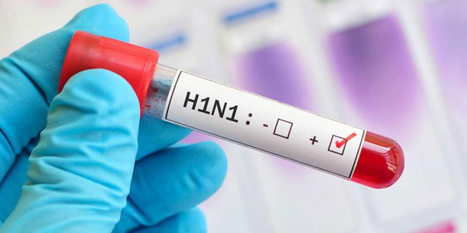 Domuz gribinden korunmak için bu önerilere dikkat!