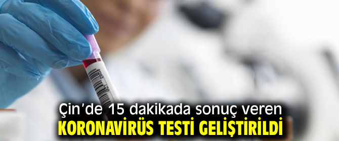 Bu test 15 dakikada koronavirüs sonucunu veriyor!