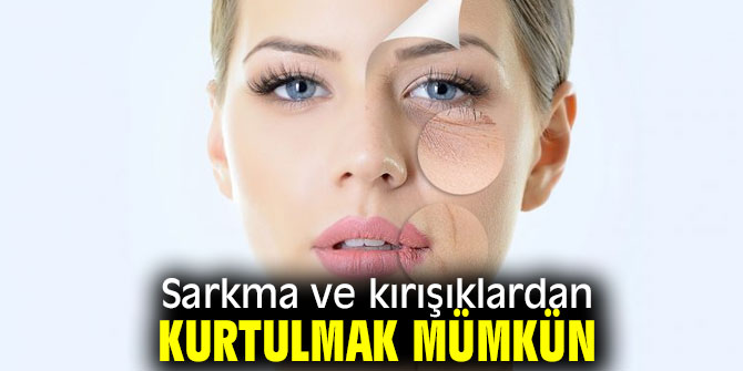 Sarkma ve kırışıklardan kurtulmak mümkün