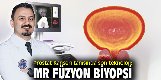 Prostat Kanseri tanısında son teknoloji: MR Füzyon Biyopsi