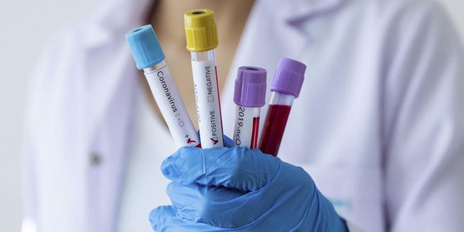 Uzmanı uyardı! Salgın Ortamında Ruh Sağlımıza Dikkat Edelim