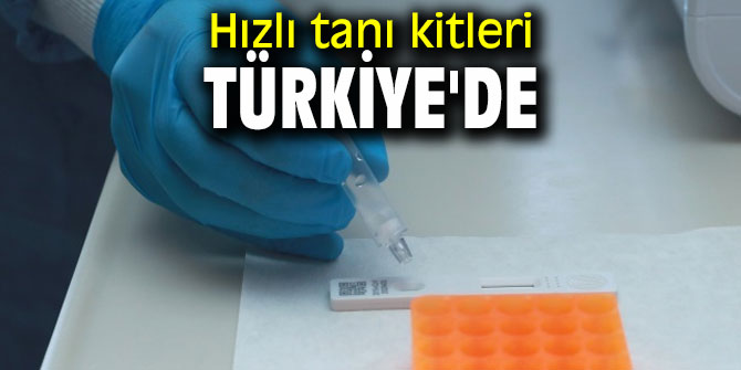 Hızlı tanı kitleri artık Türkiye'de
