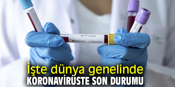 İşte dünya genelinde koronavirüste son durumu