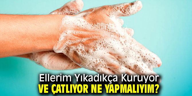 Sık yıkamakla kuruyan elleri korumanın yolları!