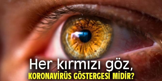 Her kırmızı göz, koronavirüs göstergesi midir?