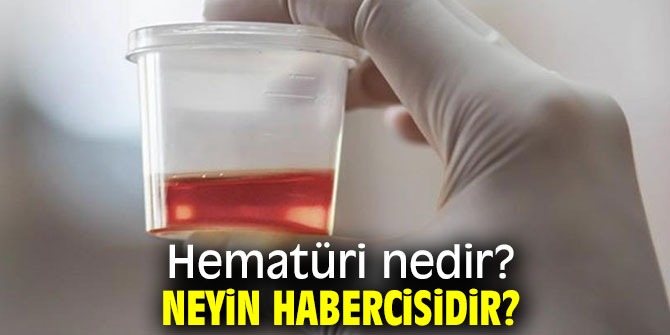 Hematüri nedir? Neyin Habercisidir?