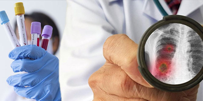 İçişleri Bakanlığı'ndan 81 il Valiliğine koronavirüs genelgesi!