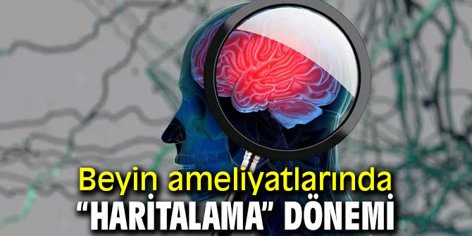 Beyin ameliyatları kişiselleşme yolunda!