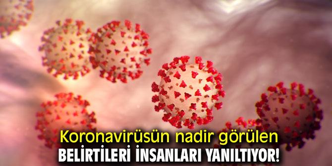 Antony, "Koronavirüsün nadir görülen belirtileri insanları yanıltıyor!"