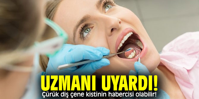 Dikkat! Çürük diş çene kistinin habercisi olabilir!