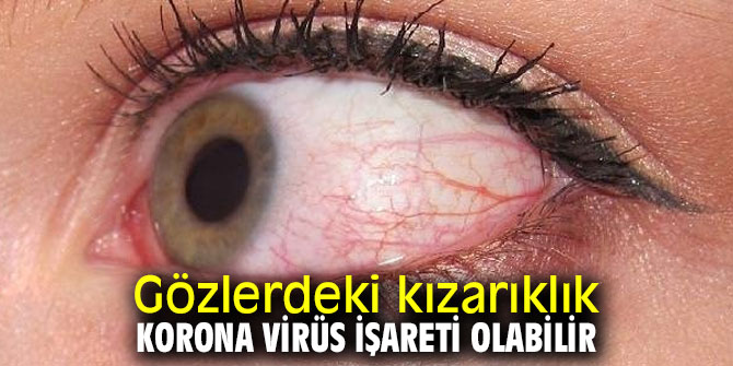 Gözlerdeki kızarıklığa dikkat!