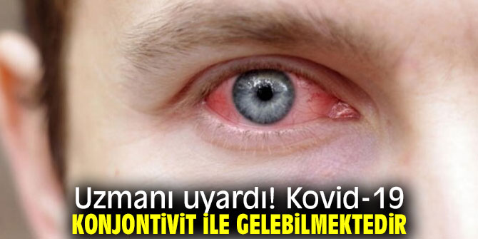 Uzmanı uyardı! Kovid-19 konjontivit ile gelebilmektedir