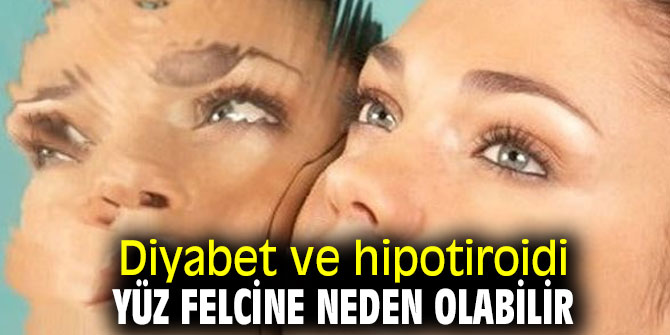Diyabet ve hipotiroidi yüz felcine neden olabilir