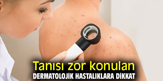 Dermatolojik hastalıklara dikkat!