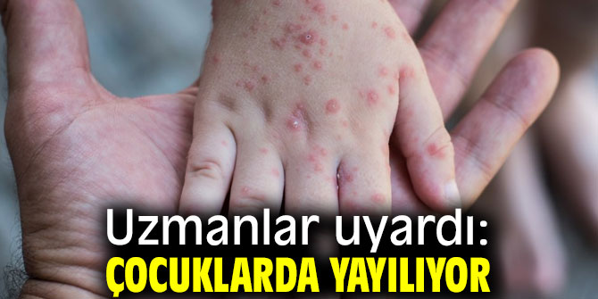 Uzmanlar uyardı: Çocuklarda yayılıyor!