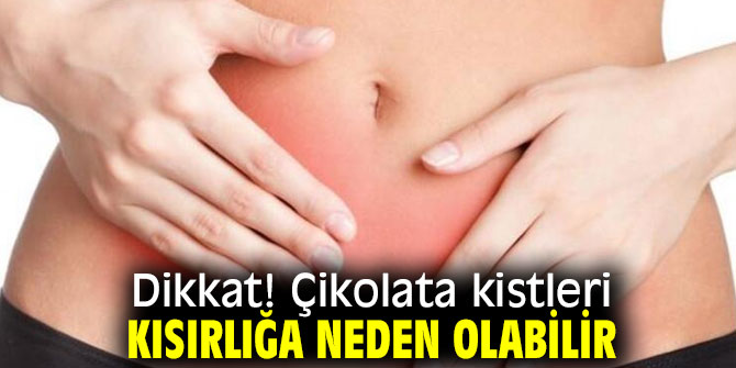 Dikkat! Çikolata kistleri kısırlığa neden olabilir