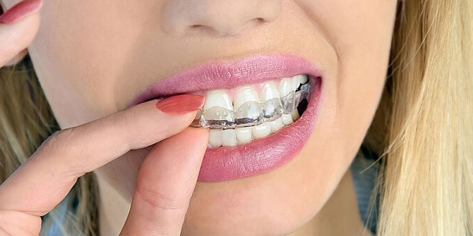 Bruksizm hakkında bilinmesi gerekenler!