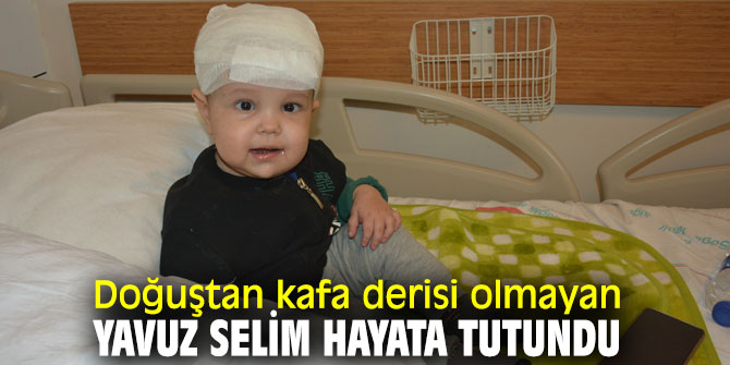 İzmir'de doğuştan kafa derisi olmayan Yavuz Selim hayata tutundu...