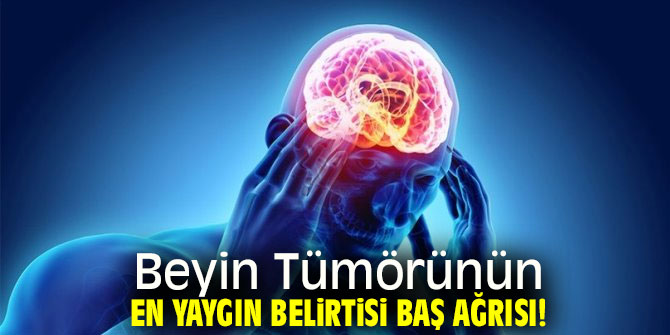 Aman dikkat! Baş ağrınızın sebebi...